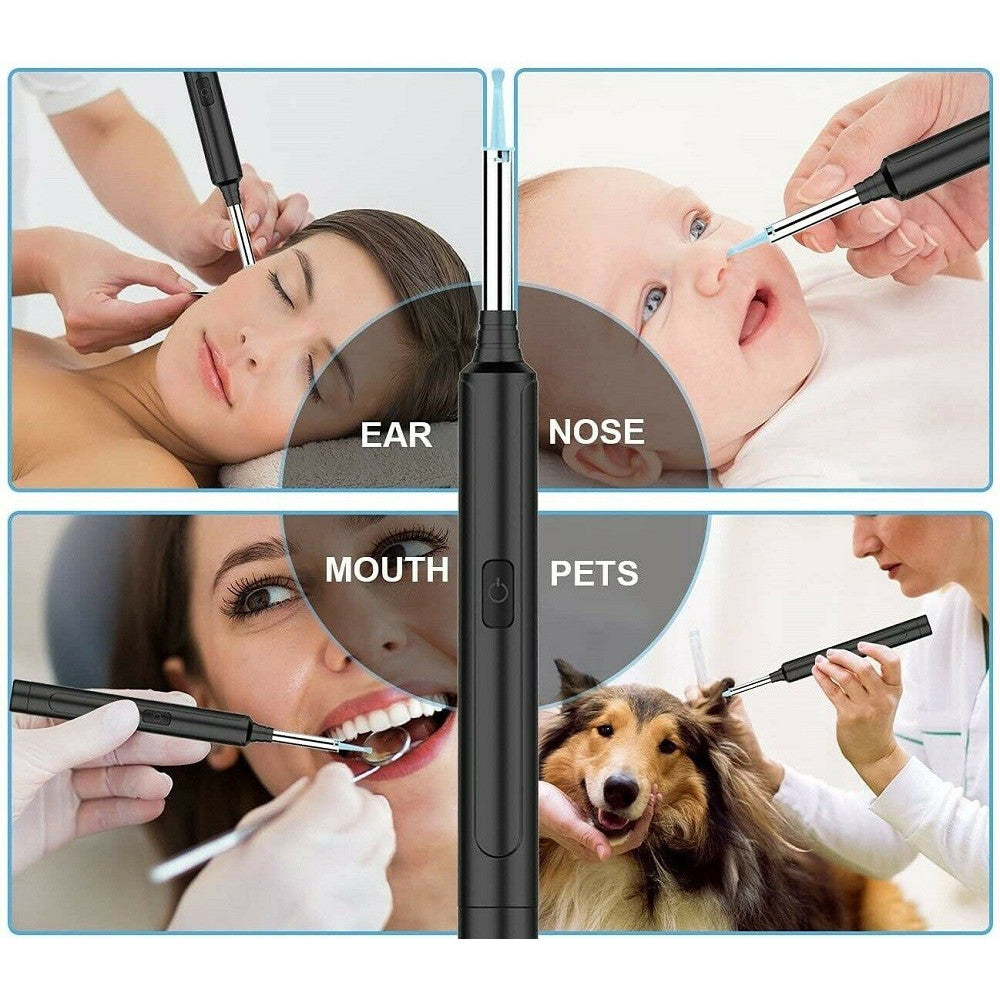 OTOSCOPIO ISPEZIONE ORECCHIO KIT RIMOZIONE CERUME WIFI MICROSCOPIO CAMERA Q-ES1